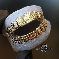 Gold Teeth Canada