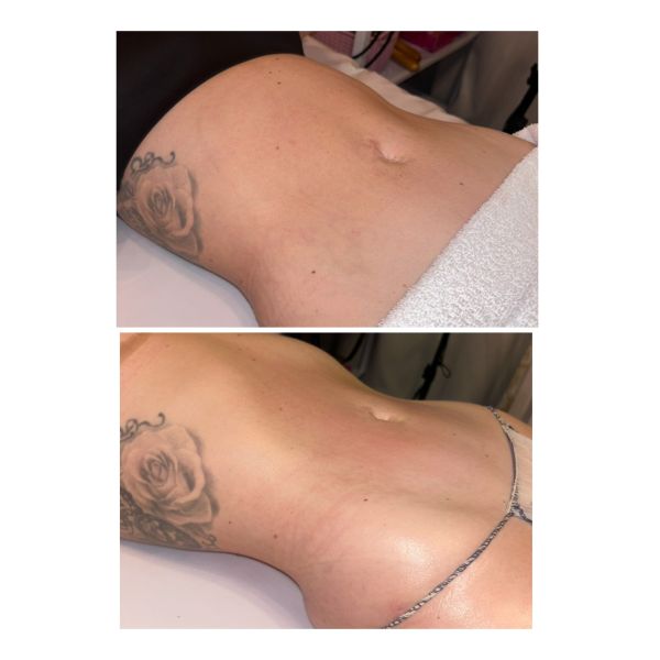 Sally's Body Bar