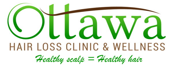 Ottawa Hair Loss Clinic & Wellness