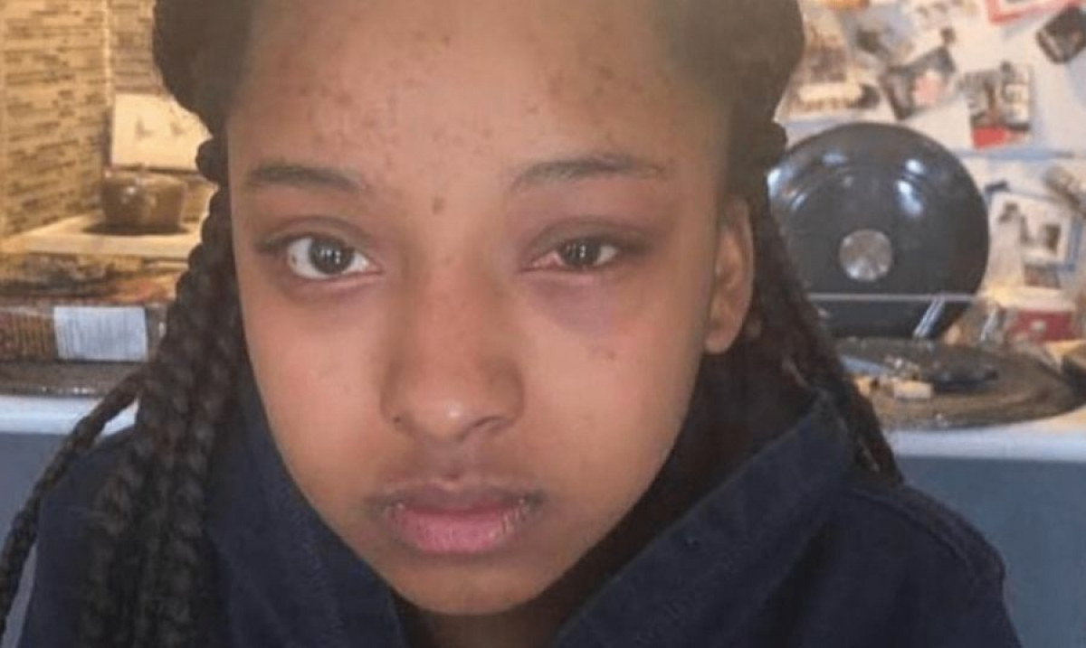 The Safety Epidemic Facing Black Children In Ontario Schools